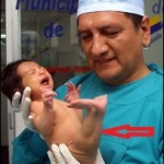 a baby with mermaid syndrome